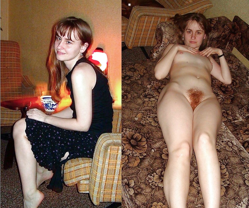 Before after 306 (Young girl special). #3593603