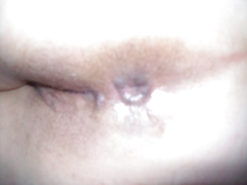 Assstrip #3705695