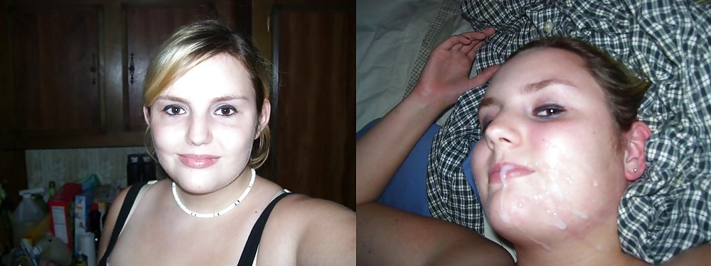 Prima e dopo i trattamenti al viso: giovani e milf
 #14465960