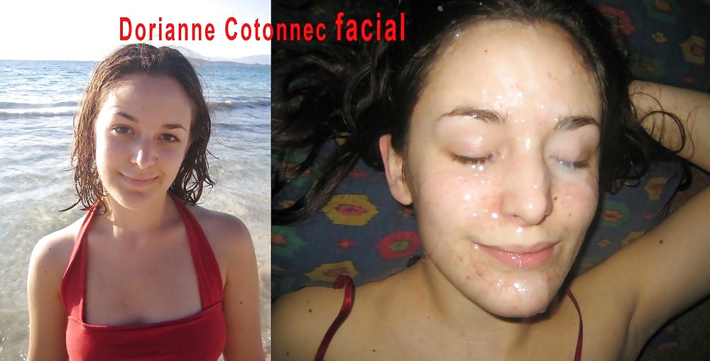 Before and After Facials 2 #3887135