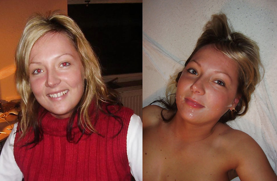 Before And After Facials 2 Porn Pictures Xxx Photos Sex Images