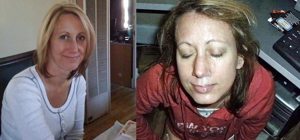 Antes y después de faciales 2
 #3887215