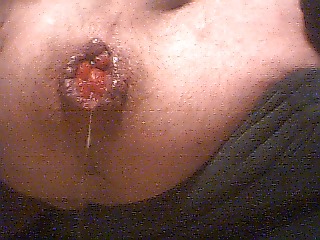 Dialating my asshole #3706247