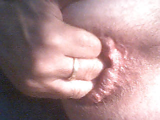 Dialating my asshole #3706290