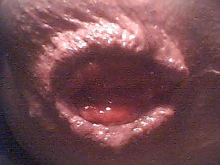 Dialating my asshole #3706311