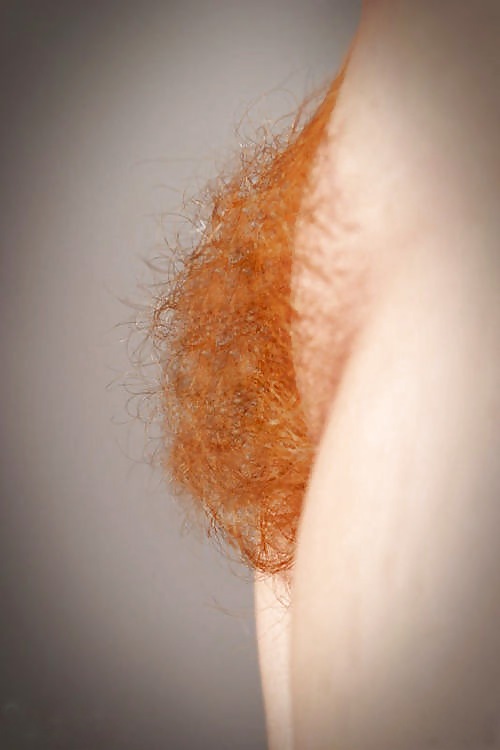 Frecklicious - より多くの赤毛
 #10246380