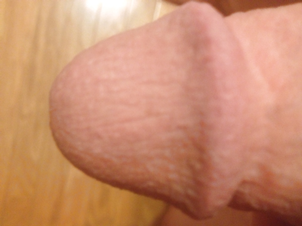 The tip #20327017