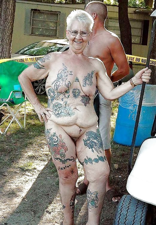 Stretch Marks, Scars and Saggy 6 #17918566