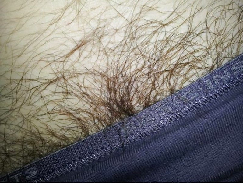 Hairy... #13439840