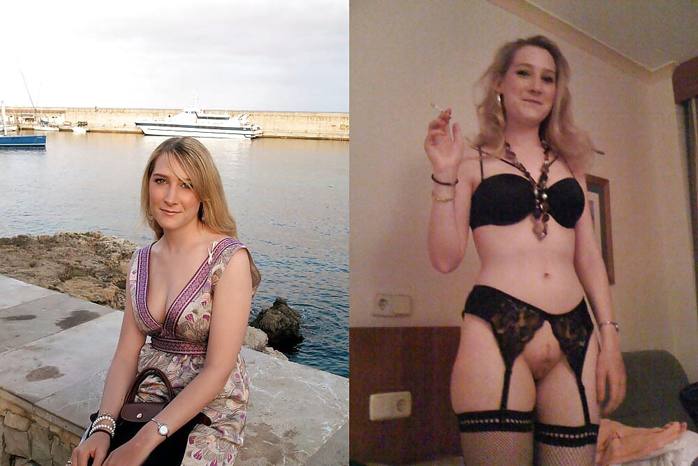 Before and  After 02 #3225811