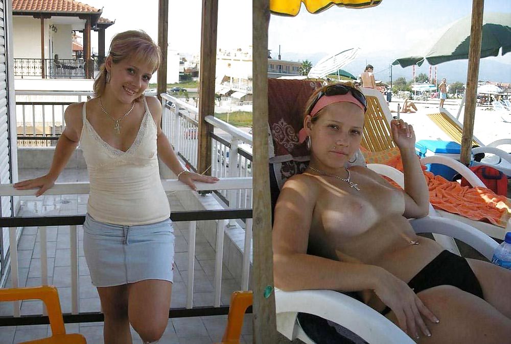 Before and  After 02 #3225912