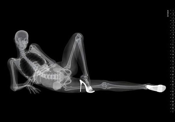 X-Rayed Sex