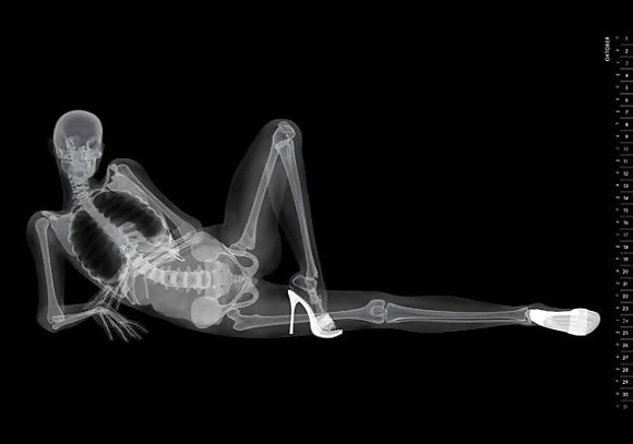 X-Rayed Sex #11002748