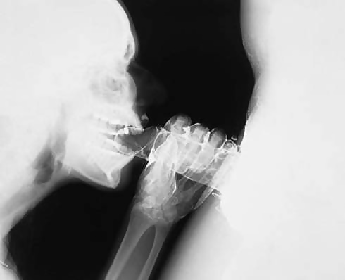 X-Rayed Sex #11002794