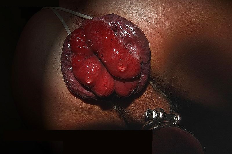 Loosed mancunt
 #21427828