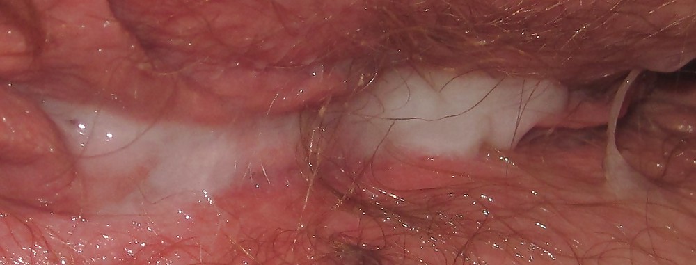 CloseUp #7340092