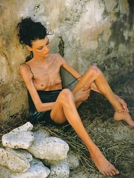 Thin and Sexy - Donate to FTW! #9833106