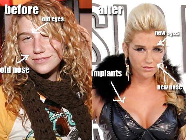 Kesha collection #668778