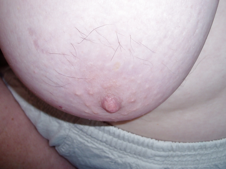 Wife's hairy nipple