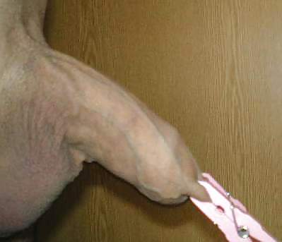 Prepucio pinzado
 #12411726