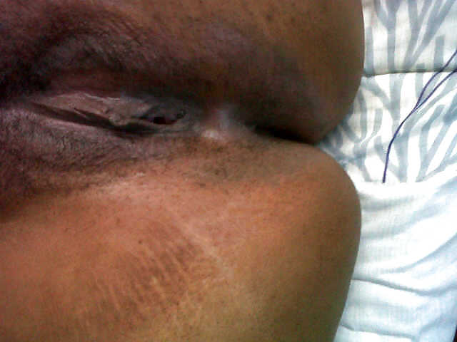 I try again :( #11331209