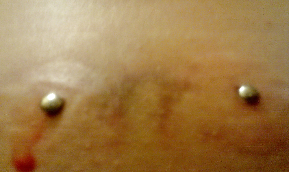 Micro dermales
 #3036461