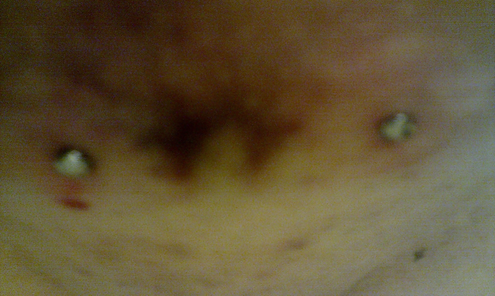 Micro dermales
 #3036475