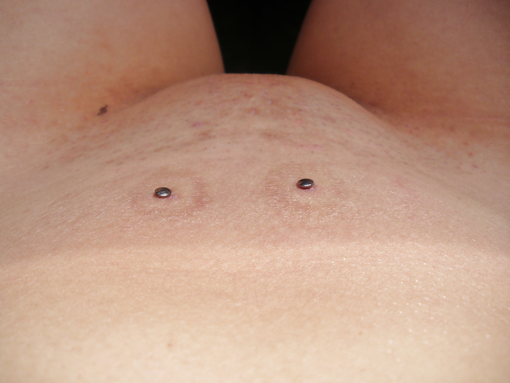 Micro dermales
 #3036504