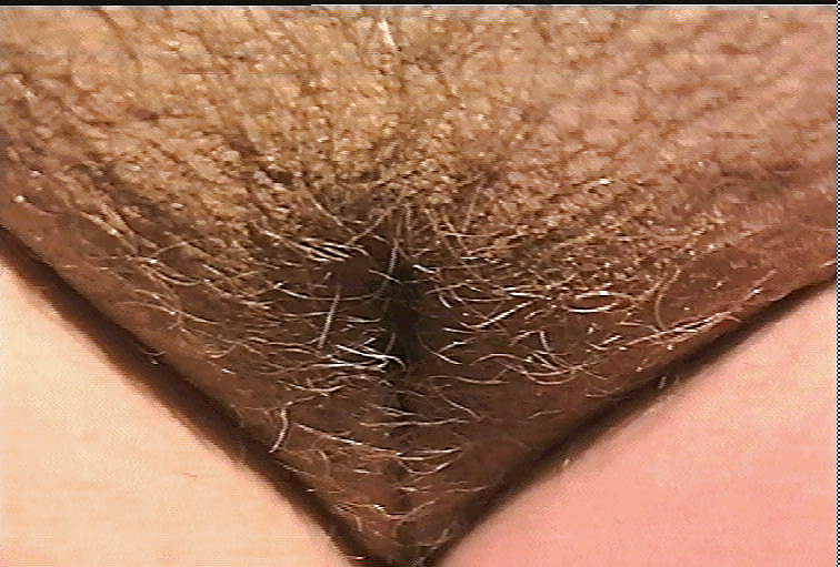 Meine Ex Alte Bilder , old Pics 