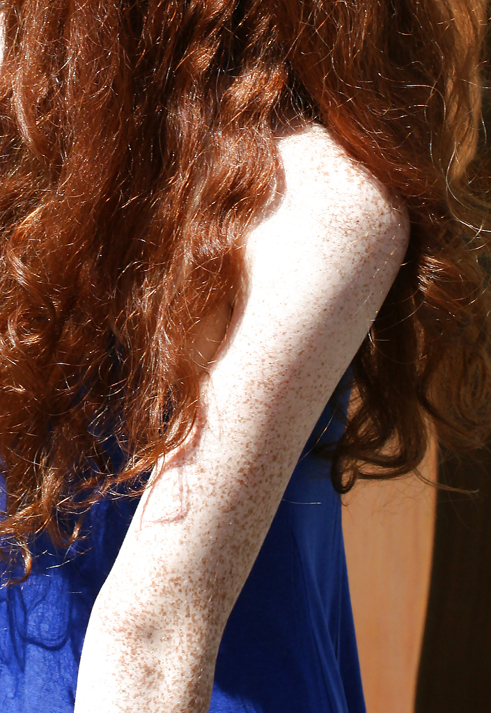 Redheads and Freckles 2 of 4  #11741970