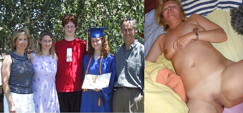 Before after 190. #4121259