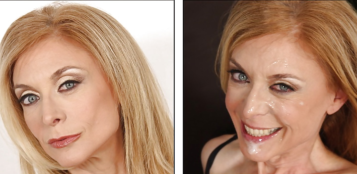 Prima e dopo i trattamenti del viso
 #4274130