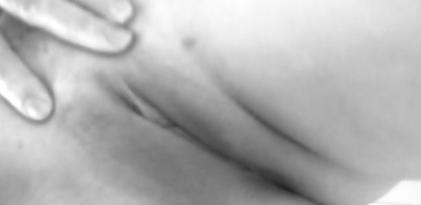 Su visión
 #17508080