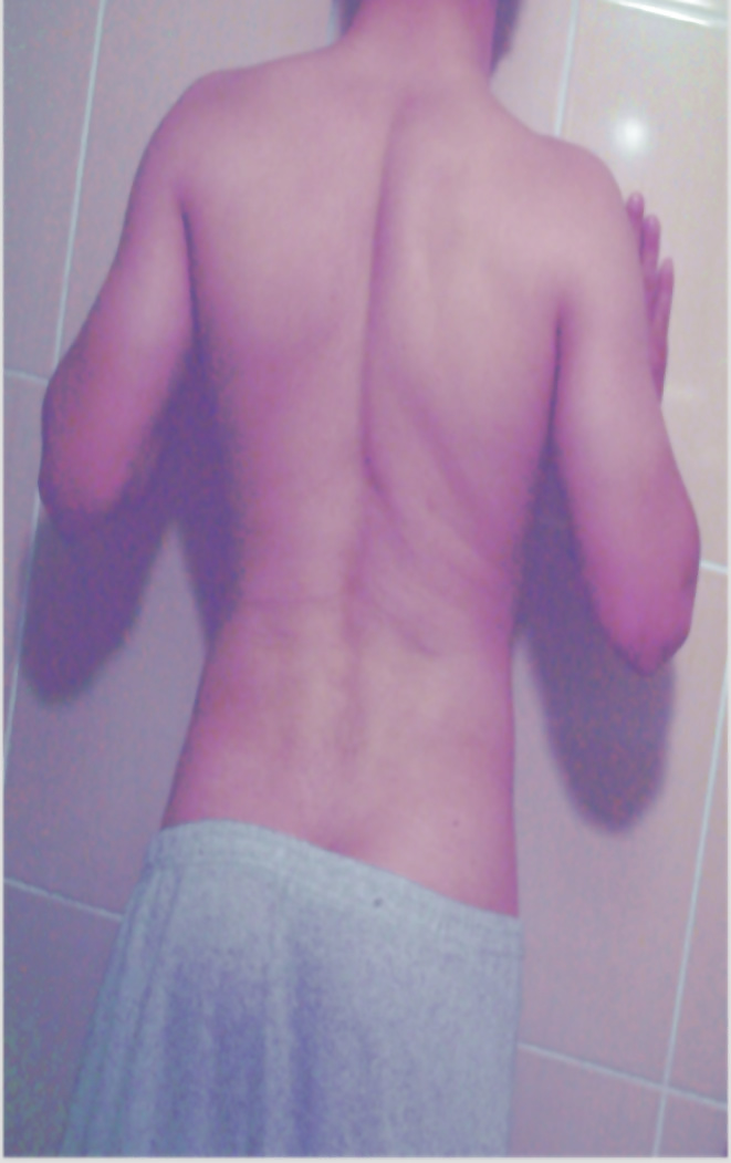 Mee
 #18967237