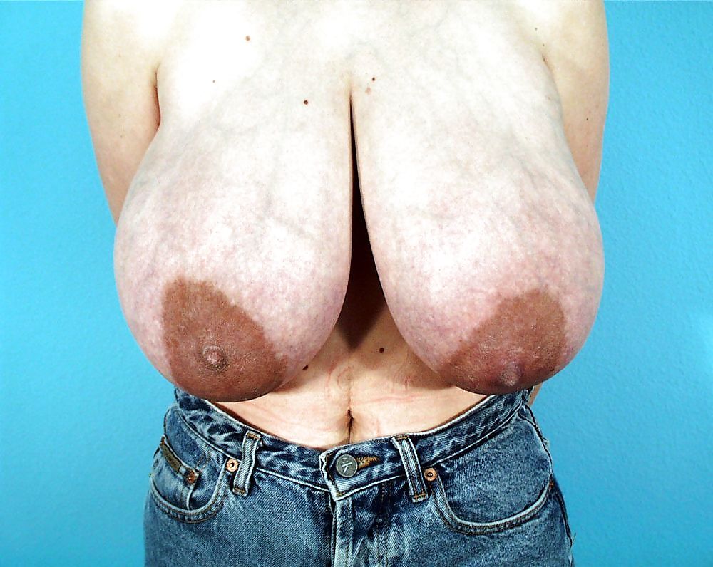 大きな天然の垂れ乳の手術前の写真
 #1651133