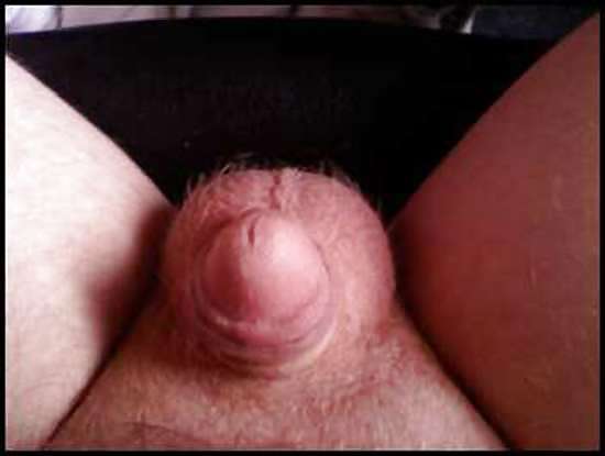 Smallest Penis Ever #9636005