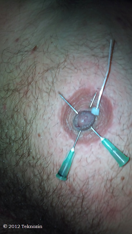 Nipple torture with needle #16266734
