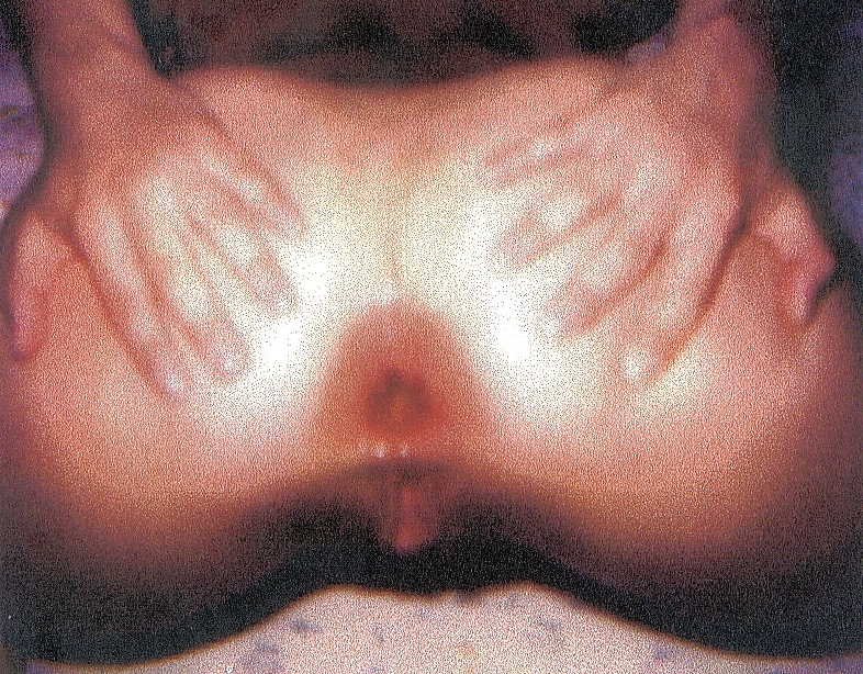 肛門の写真は、xでクローズアップ
 #208994