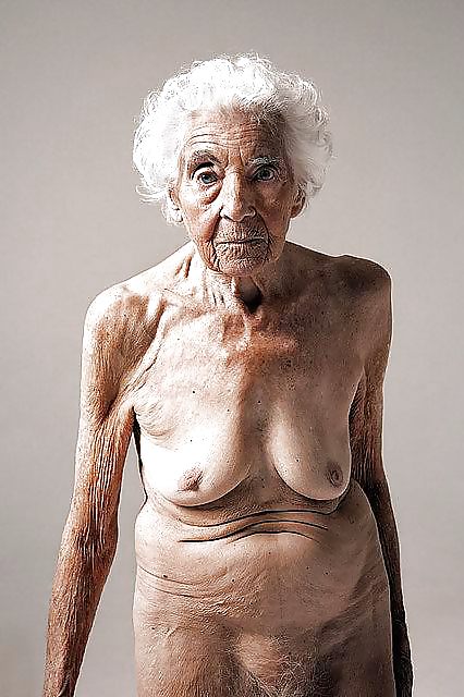 Stretch Marks, Scars and Saggy 17 #16805959