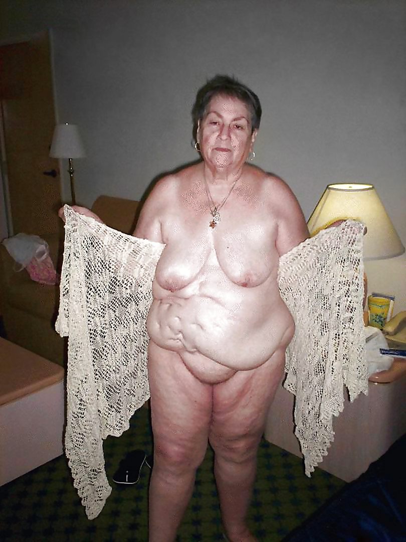 Stretch Marks, Scars and Saggy 17 #16806005