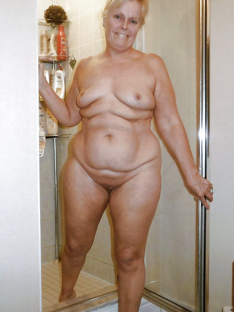 Stretch Marks, Scars and Saggy 17 #16806023