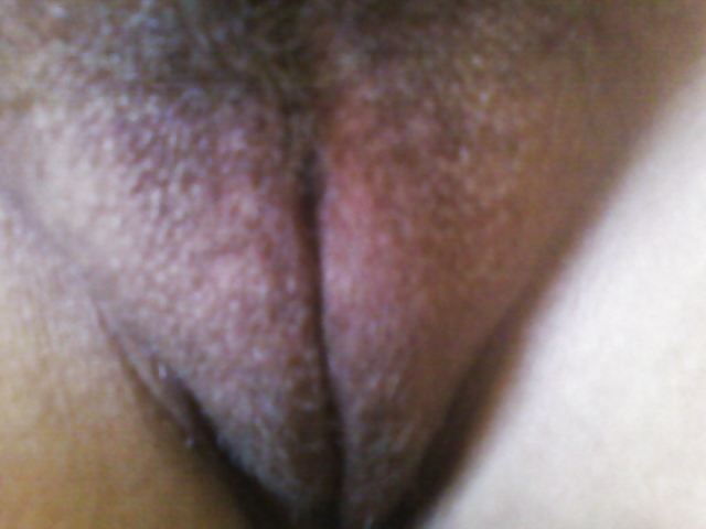 Pics of Me #3402777