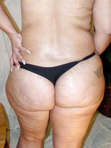 For Cellulite Lovers Only #2240464