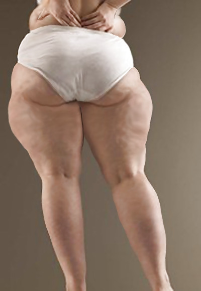 For Cellulite Lovers Only #2240986