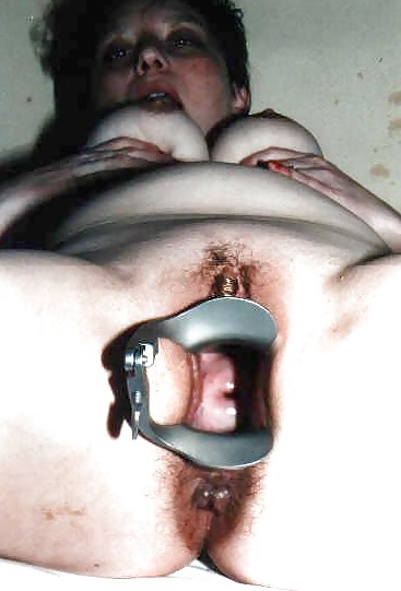 SPECULUM SPREDING #15744308