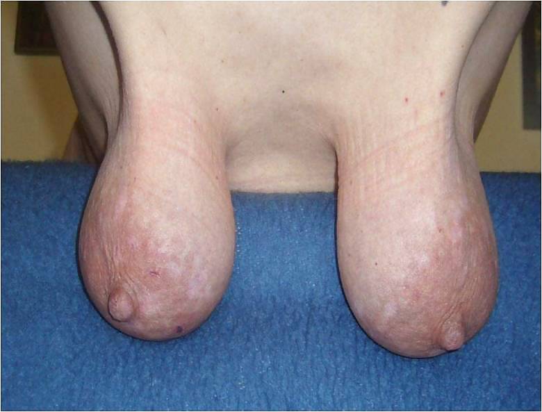 Saggy #8720900