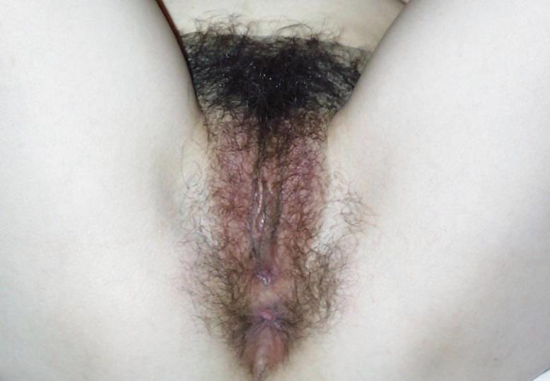 Hairy Amateur Pussy Late Summer Offensive 1 #1114923