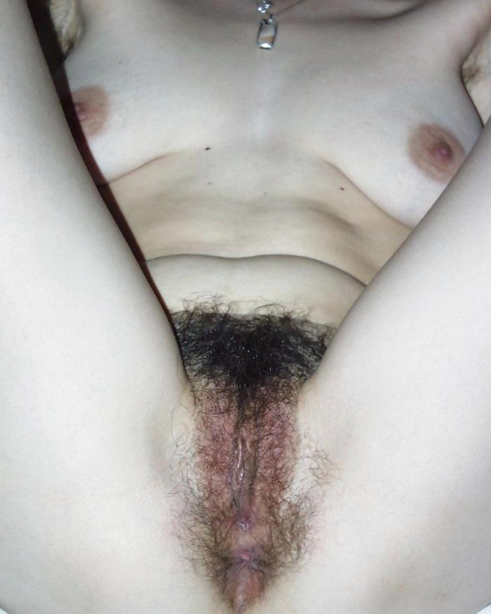 Hairy Amateur Pussy Late Summer Offensive 1 #1114959