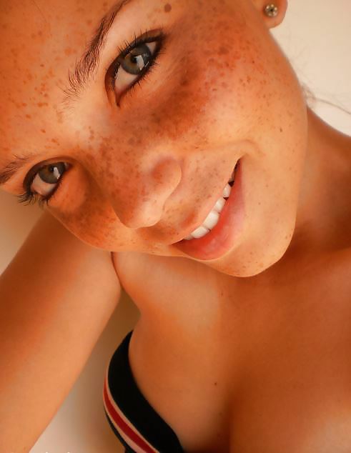 S.e.X.y Freckles #21091275