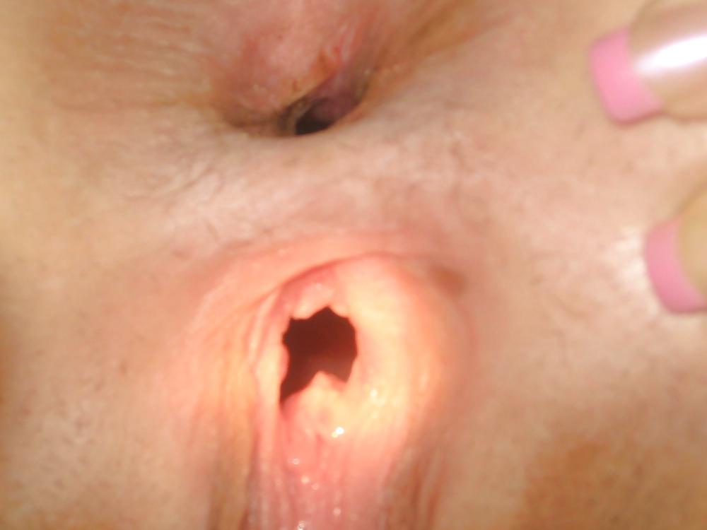 Intimnoe foto krasavics 
 #13688768